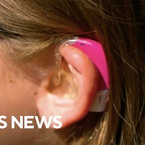 What to know about over-the-counter hearing aids