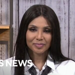 Toni Braxton on living with lupus and spreading awareness about the disease