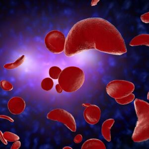 FDA considers gene-editing treatment for sickle cell disease