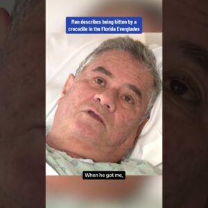 Man describes being bitten by crocodile in Florida #shorts