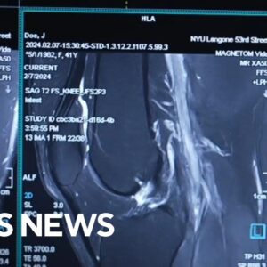 Breakthrough MRI technology uses AI for faster scans