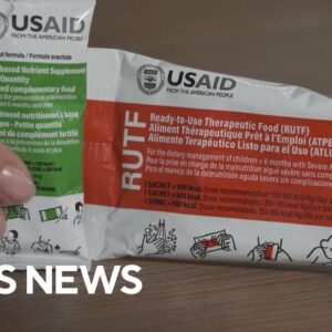 Malnutrition food product sees funding affected by USAID cuts