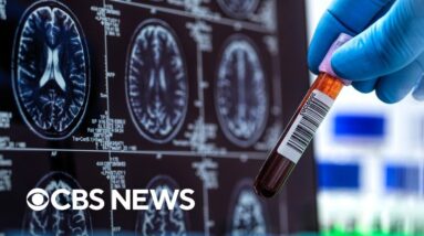 Alzheimer's Association says some blood tests can be used to diagnose the disease