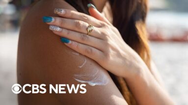 "Please do not" use homemade sunscreen, doctor warns amid anti-sunscreen movement on social media
