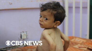 Food crisis group declares Gaza City famine, expects spread