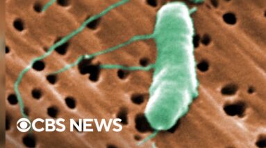 Flesh-eating bacteria kills fifth person this year in Louisiana