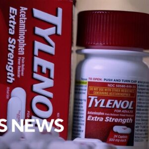 Fact-checking the science behind Trump administration's Tylenol, autism claims