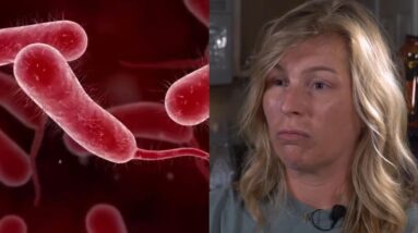 Survivor of flesh-eating bacteria speaks out: "Just thankful to be here"