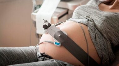 Fetal monitors drive high C-section rates in U.S., New York Times report finds